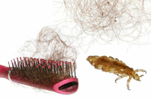 Head lice: How to get rid of them and stop them coming back