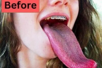 How a Long Tongue is Connected to Love